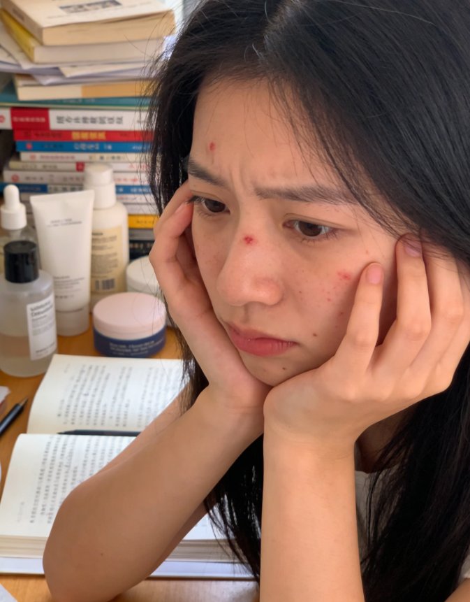 经前爆痘，是谁在“搞鬼”？